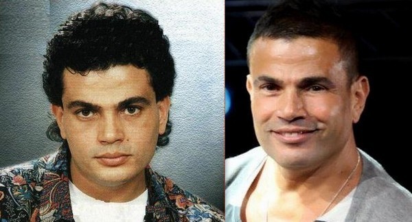 Arab Celebrities Before After